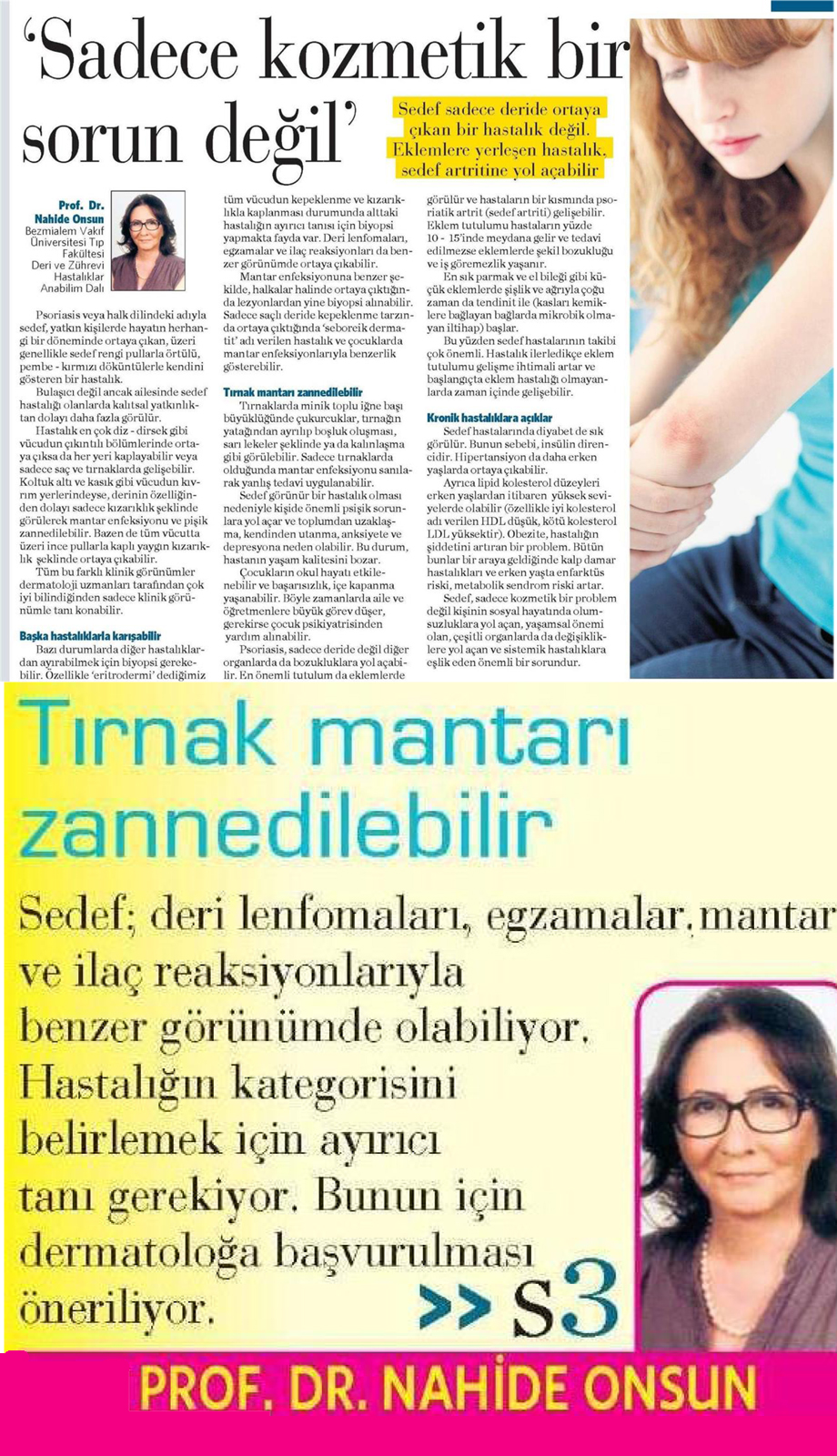 milliyet-tirnak-mantari-zedelenebilir-29-10-2015.jpg